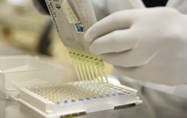 RJ inicia um dos maiores sequenciamentos de variantes da Covid-19 do Brasil